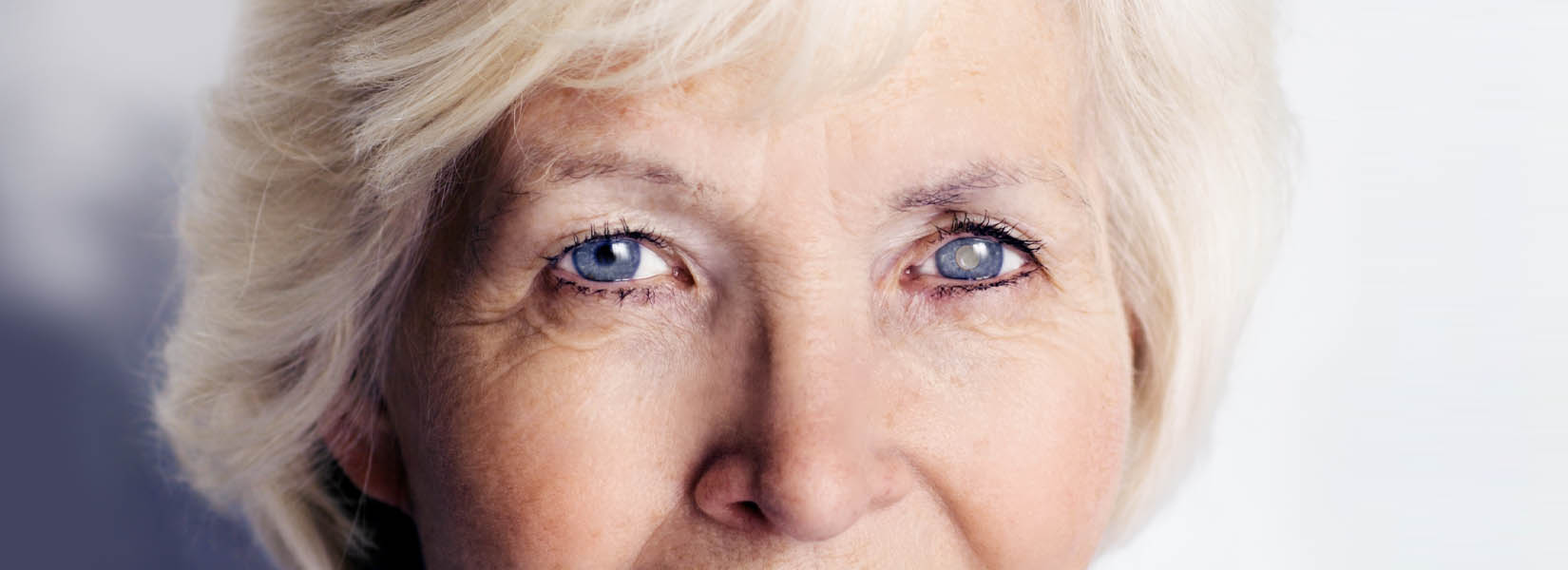 Cataract Surgery in Washington